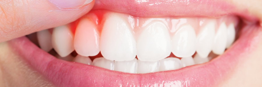 又上火又怕冷？上熱下寒、水火不濟，教你調(diào)回來！