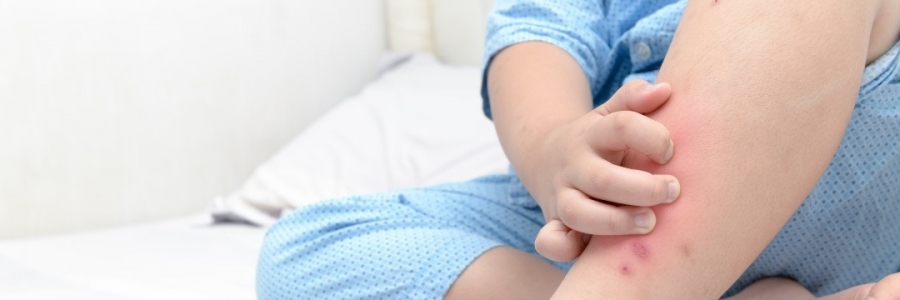 學(xué)古人這樣驅(qū)蚊，從此不再“蚊”風(fēng)喪膽！