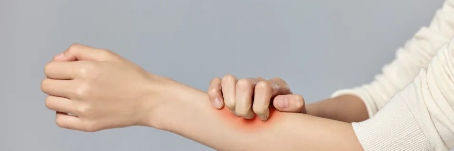 濕疹、瘙癢、蕁麻疹……患皮膚病，也許是好事！